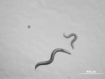 Figure 1: N2 (wild-type) hermaphrodite C. elegans movement. http://wormclassroom.org/c-elegans-phenotypes